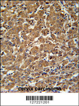 N4BP3 Antibody (N-term)