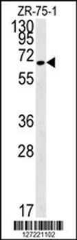 N4BP3 Antibody (N-term)