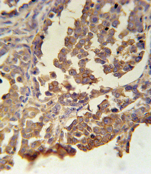 MC2R Antibody (C-term)