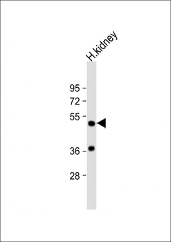 DDC Antibody (N-term)