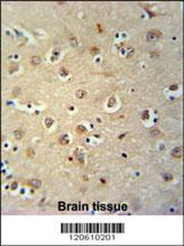 MEIS2 Antibody (Center D269)