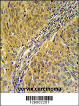 DYNC1LI2 Antibody (Center)