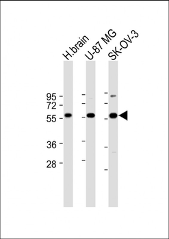 DYNC1LI2 Antibody (Center)