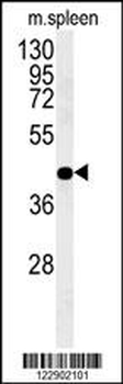 PGD Antibody (Center)
