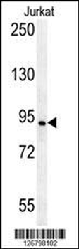 AXIN2 Antibody (C-term)