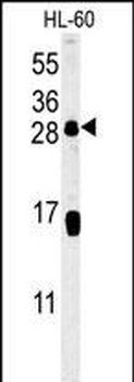 CD69 Antibody (Center)