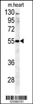B4GALT5 Antibody (C-term)