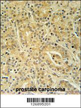 UBAC1 Antibody (C-term)