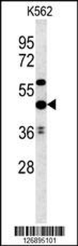 UBAC1 Antibody (C-term)