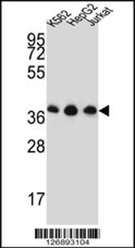 HNRPDL Antibody (Center)