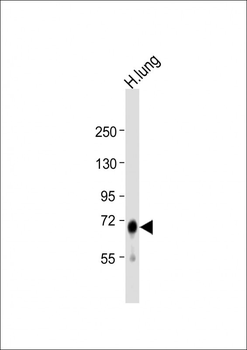IDUA Antibody (Center)