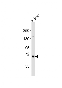 IDUA Antibody (Center)