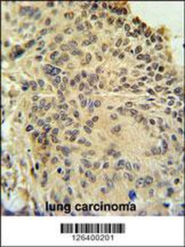 RSPO2 Antibody (C-term)