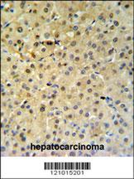 PSME1 Antibody (C-term)