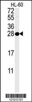 PSME1 Antibody (C-term)