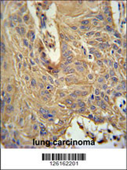 IL5RA Antibody (N-term)