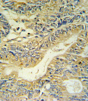 PYY Antibody (C-term)