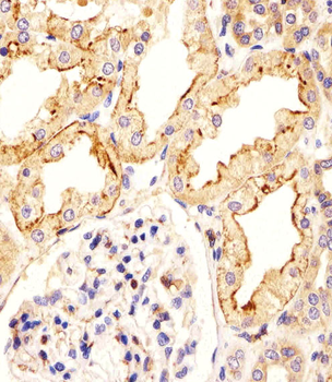 CREBL1 Antibody (C-term)