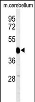 SGTB Antibody (N-term)