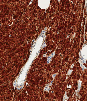 S100B Antibody