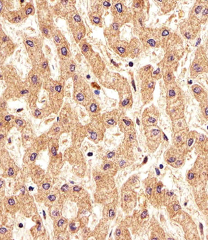 FOLH1 Antibody (Center)