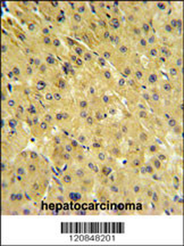 FOLH1 Antibody (Center)