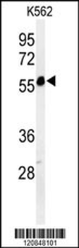 FOLH1 Antibody (Center)