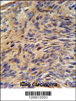 HSPA5 Antibody (Center)