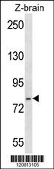 HSPA5 Antibody (Center)