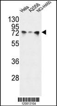 HSPA5 Antibody (Center)