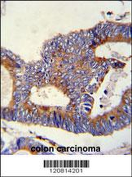 HSPA5 Antibody (C-term)