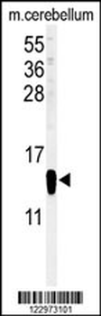 FABP7 Antibody (C-term)