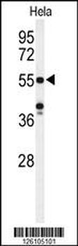 POTEH Antibody (N-term)