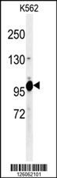 K0406 Antibody (N-term)