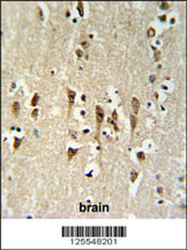 KCTD1 Antibody (C-term)