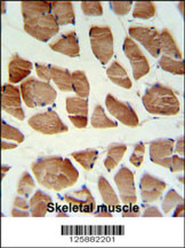 ATP2A1 Antibody (C-term)