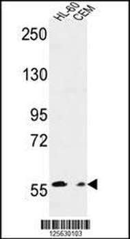 MILK2 Antibody (C-term)