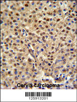 MISP Antibody (N-term)