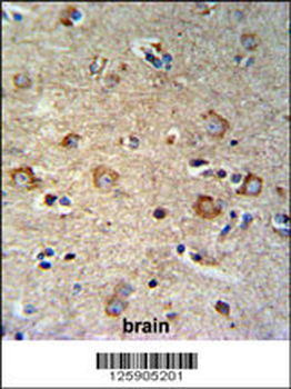 SETD6 Antibody (C-term)