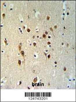 TOX3 Antibody (Center)