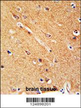 ANKFY1 Antibody (C-term)