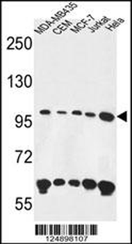 ANKFY1 Antibody (C-term)