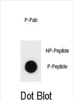 Phospho-CCNB2(S11) Antibody