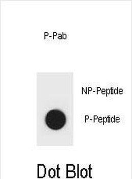 Phospho-mouse IKKB(S701) Antibody