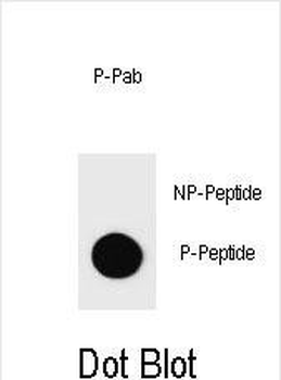 Phospho-BAD(S71) Antibody