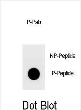 Phospho-YAP(S127) Antibody