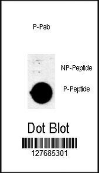 Phospho-AKT1(Thr308)) Antibody