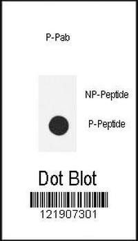 Phospho-eNos(S1177) Antibody