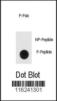 Phospho-NSE(Y236) Antibody
