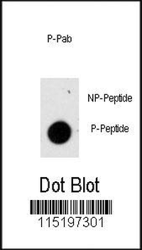 Phospho-GFAP(S8) Antibody